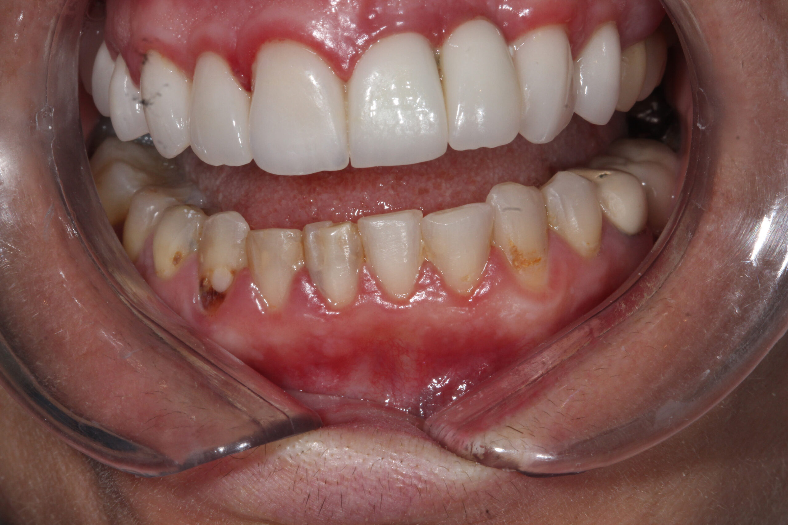ANTES 1 - ODONTO VIDA