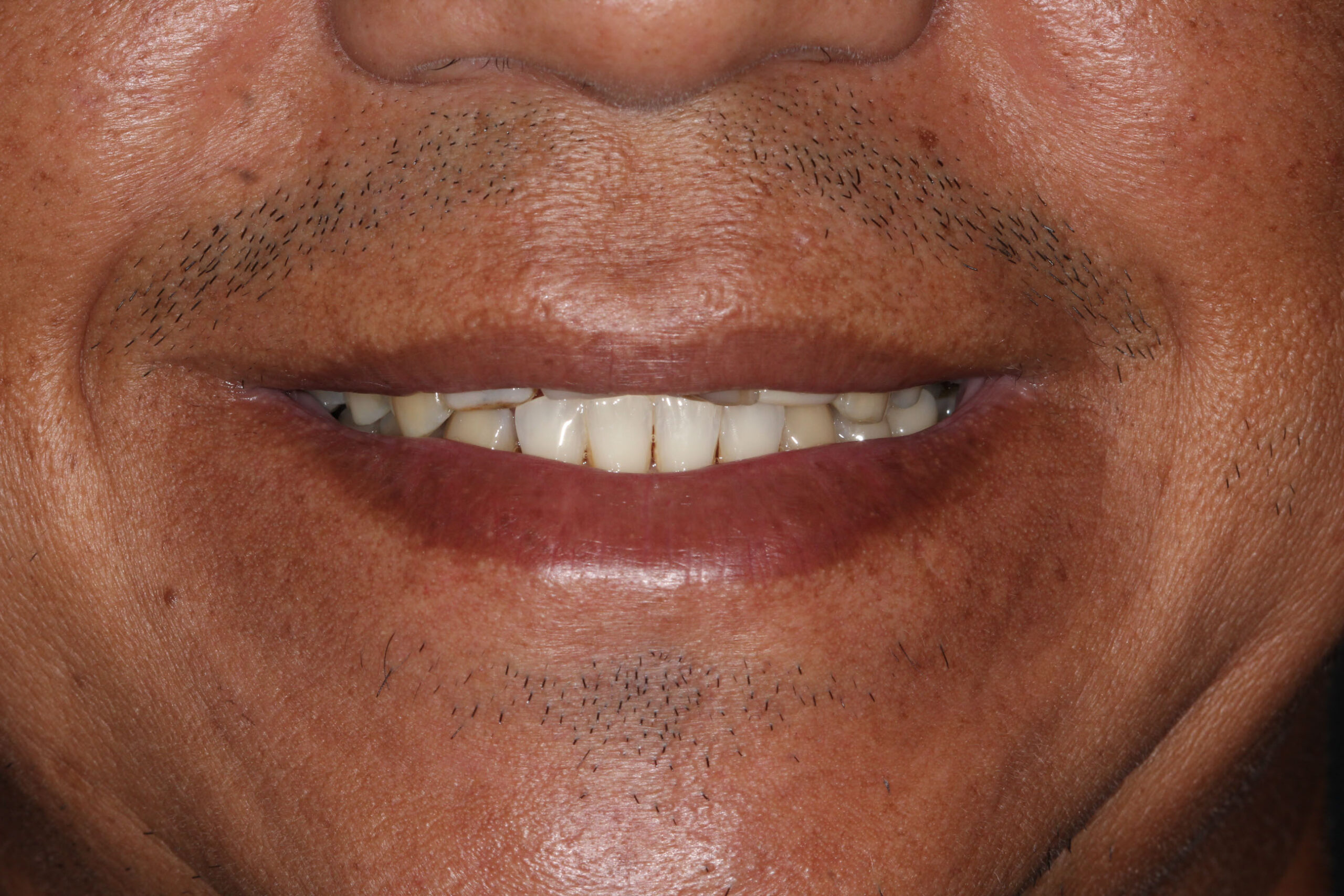 antes 2 odonto